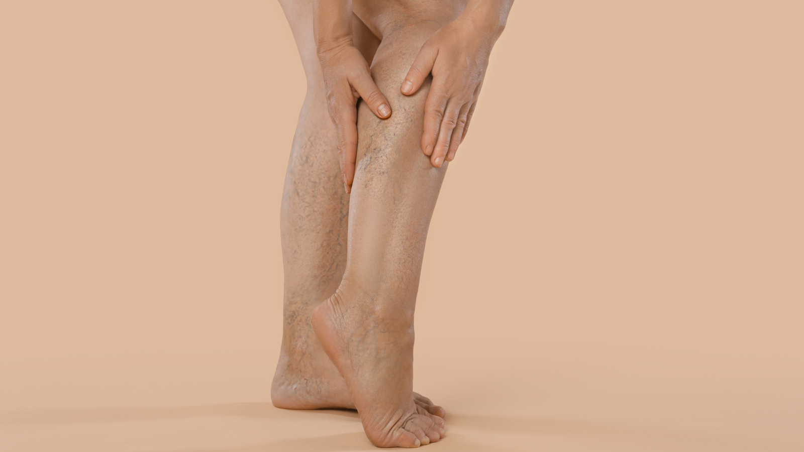 Edema nas Pernas: 7 Causas Vasculares e Quando se Preocupar | Angioclínica